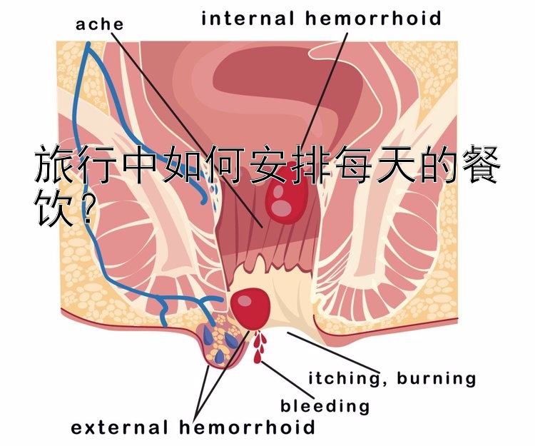 旅行中如何安排每天的餐饮？