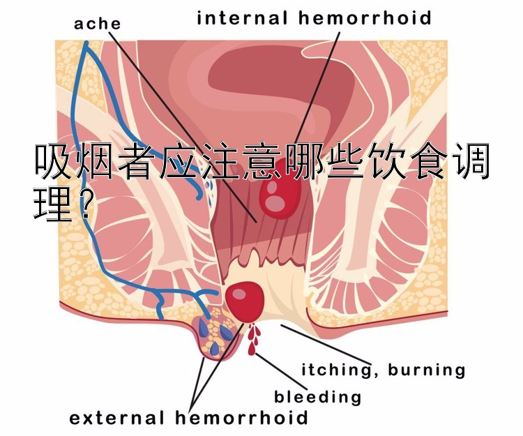 吸烟者应注意哪些饮食调理？