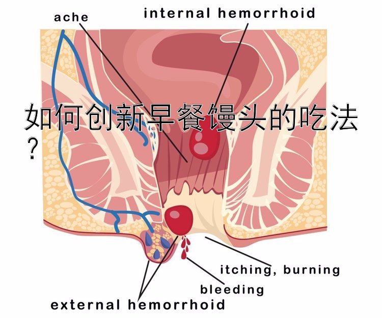 如何创新早餐馒头的吃法？