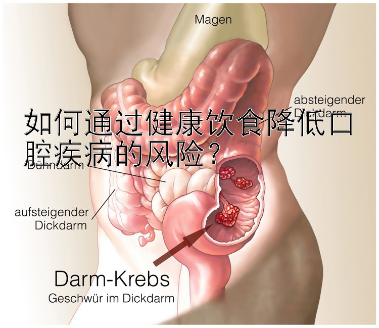 如何通过健康饮食降低口腔疾病的风险？