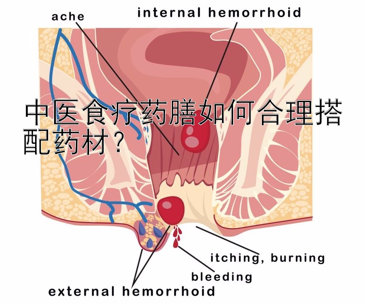 中医食疗药膳如何合理搭配药材？