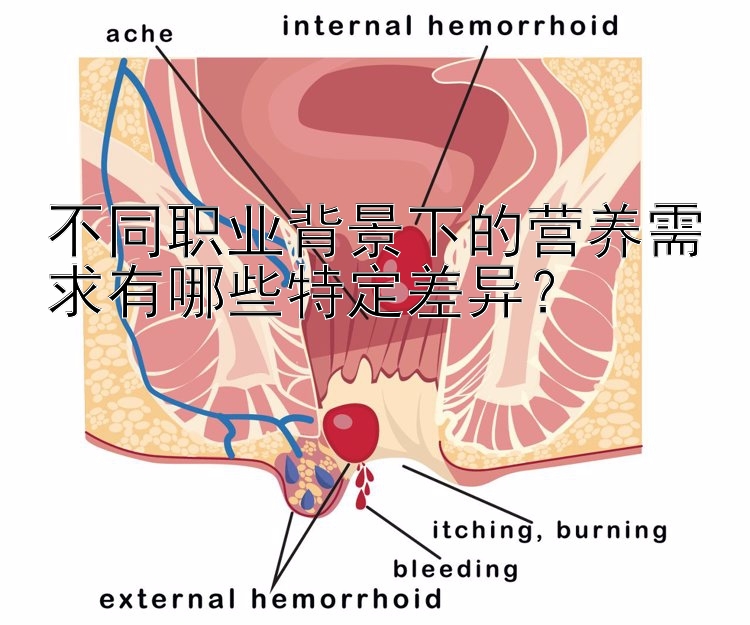 不同职业背景下的营养需求有哪些特定差异？