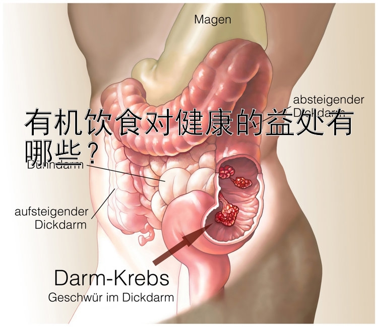 有机饮食对健康的益处有哪些？