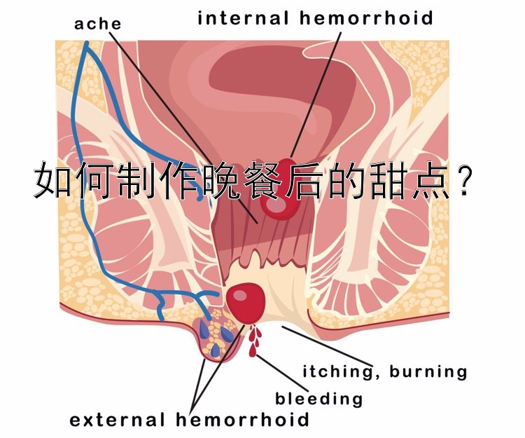 如何制作晚餐后的甜点？