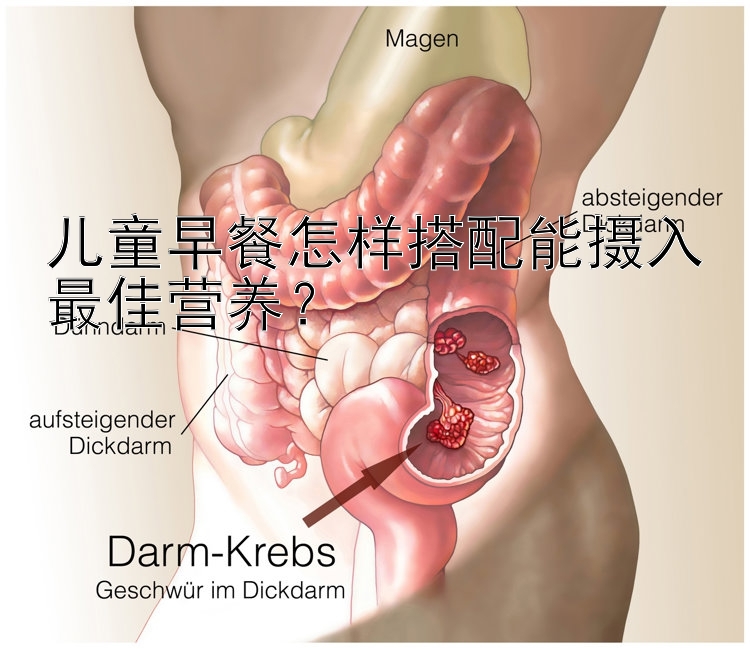 儿童早餐怎样搭配能摄入最佳营养？