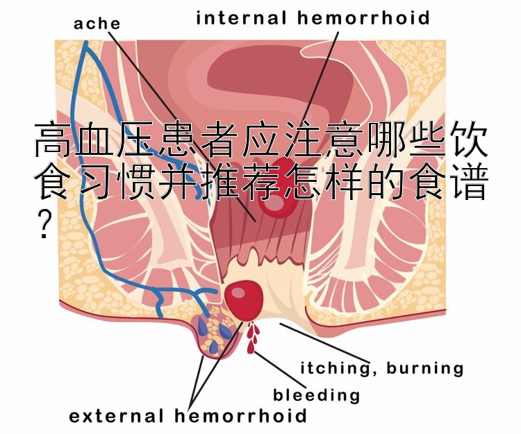 高血压患者应注意哪些饮食习惯并推荐怎样的食谱？