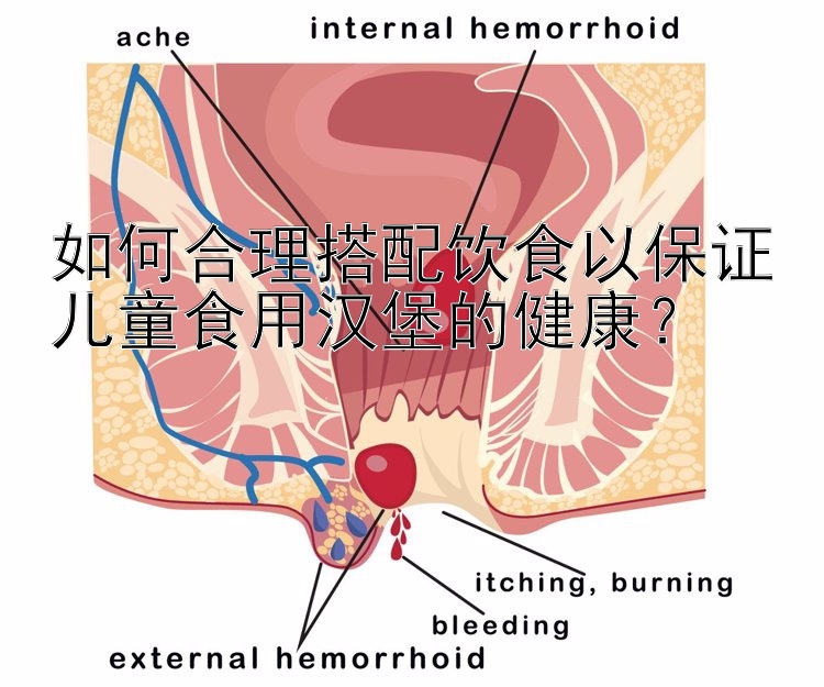 如何合理搭配饮食以保证儿童食用汉堡的健康？