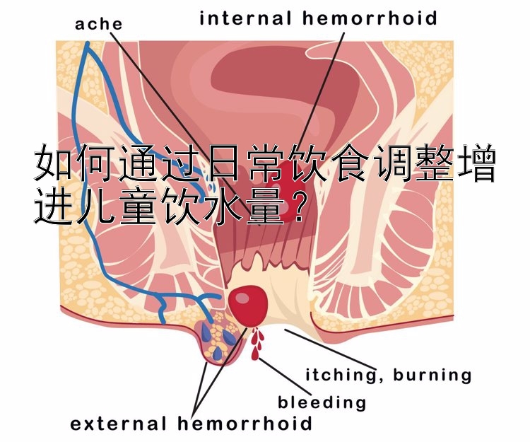 如何通过日常饮食调整增进儿童饮水量？