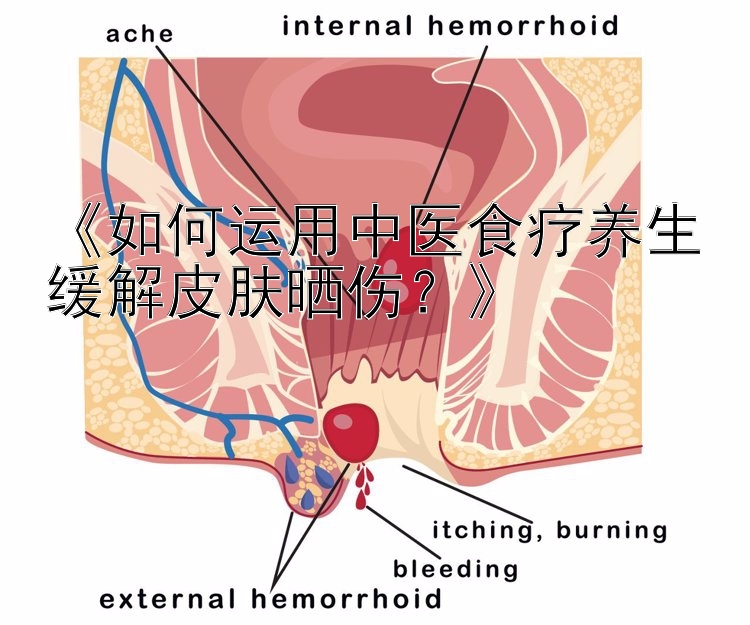 《如何运用中医食疗养生缓解皮肤晒伤？》