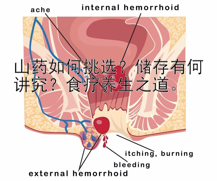 山药如何挑选？储存有何讲究？食疗养生之道。