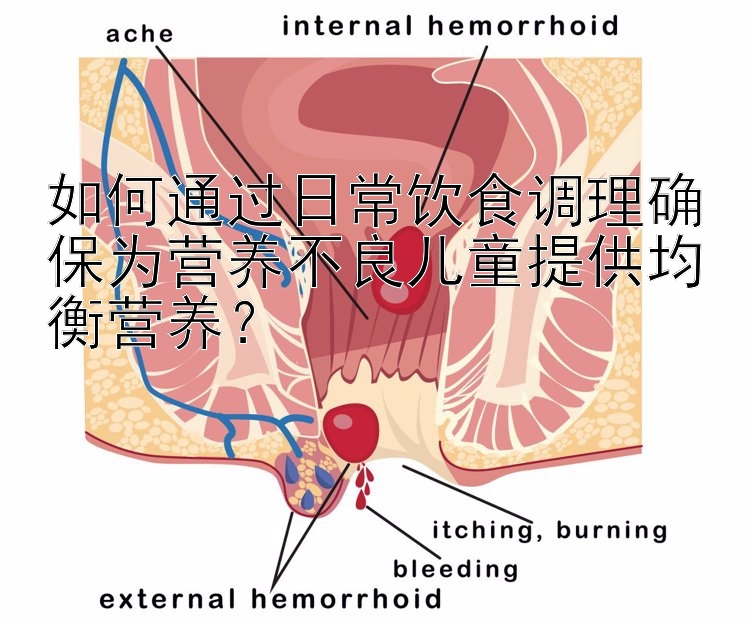 如何通过日常饮食调理确保为营养不良儿童提供均衡营养？