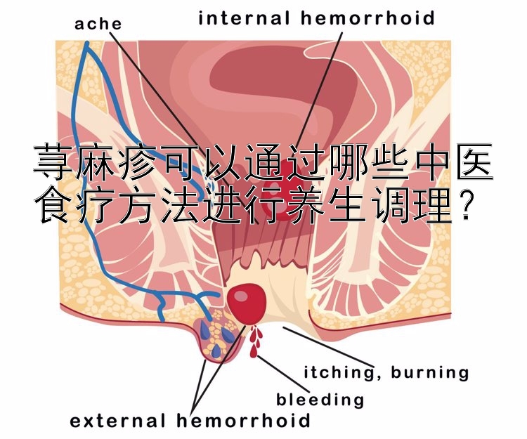 荨麻疹可以通过哪些中医食疗方法进行养生调理？