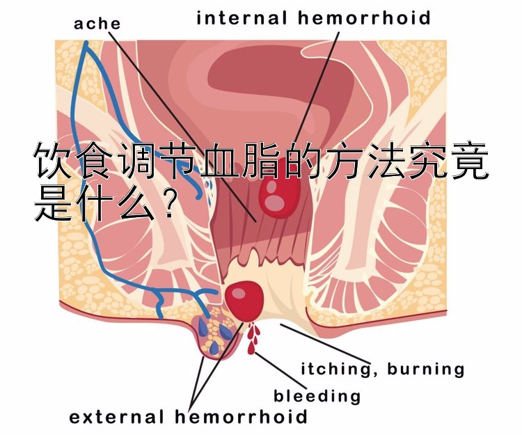 饮食调节血脂的方法究竟是什么？