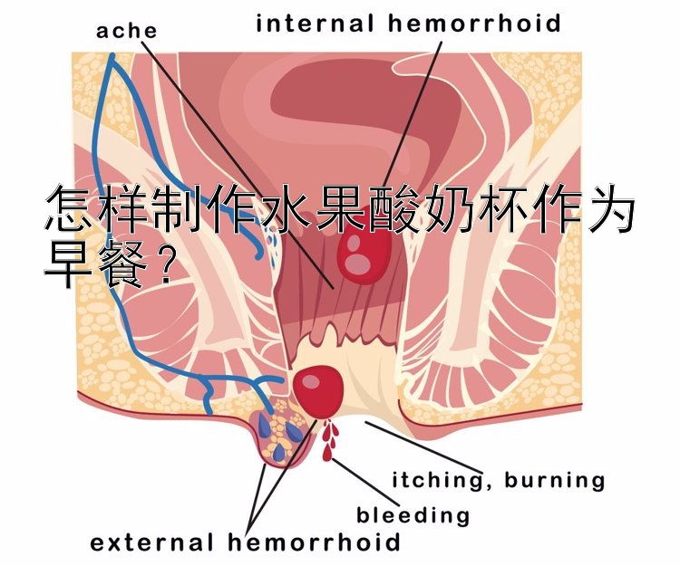 怎样制作水果酸奶杯作为早餐？