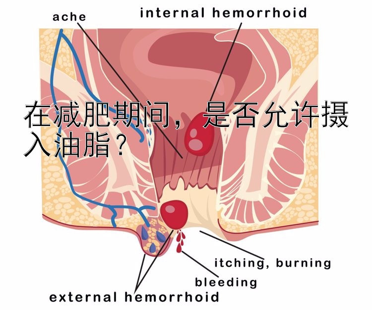 在减肥期间，是否允许摄入油脂？