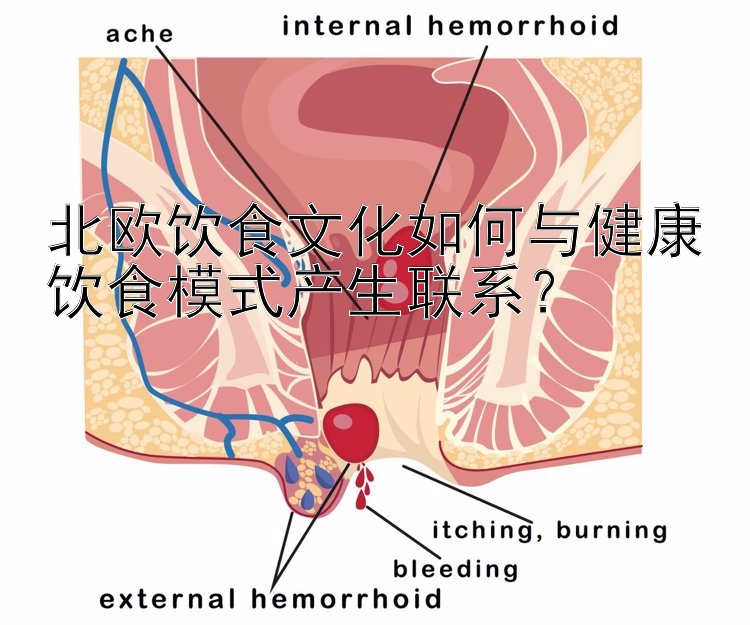 北欧饮食文化如何与健康饮食模式产生联系？