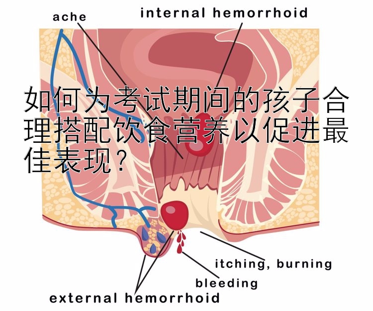 如何为考试期间的孩子合理搭配饮食营养以促进最佳表现？