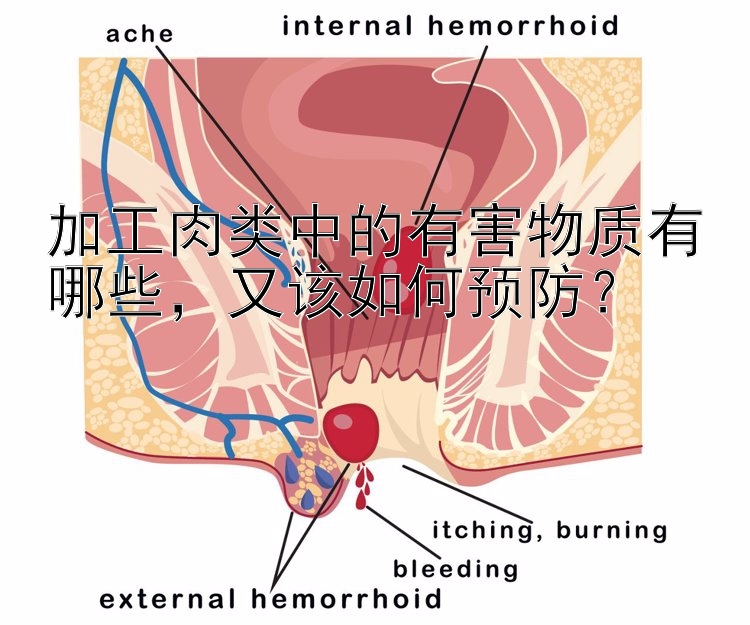 加工肉类中的有害物质有哪些，又该如何预防？