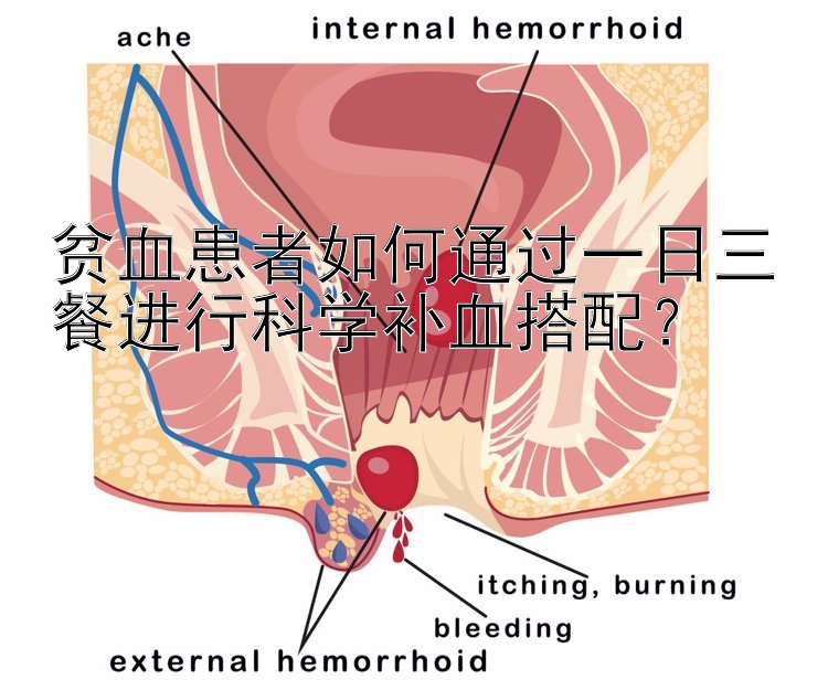 贫血患者如何通过一日三餐进行科学补血搭配？