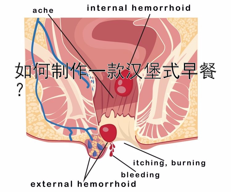 如何制作一款汉堡式早餐？